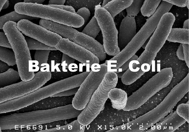 Elektronový mikroskopický záběr na bakterii E. coli.