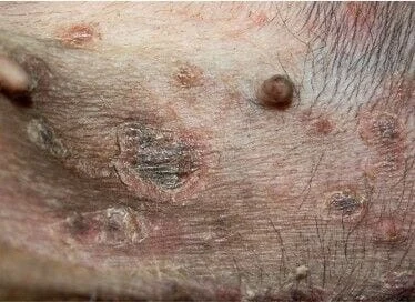 Zánětlivé pokožkové výčnělky u psa