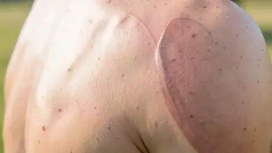 co je musculus teres major a jeho funkce - Co je musculus teres major - ilustrační foto
