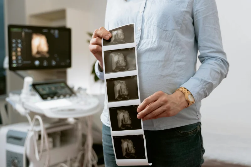 Těhotná žena drží proužek ultrazvukových snímků plodu před sonografem.
