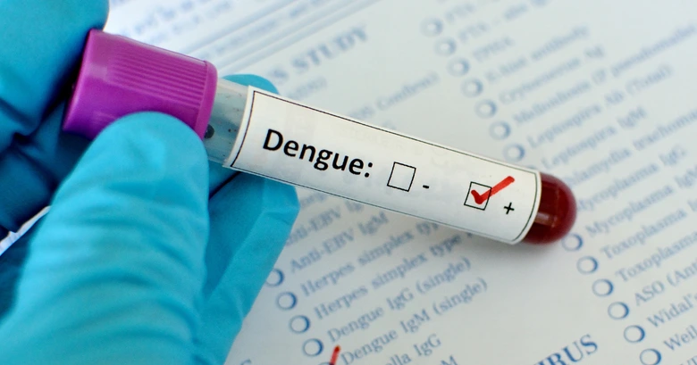 Krevní vzorek s pozitivním výsledkem testu na dengue.