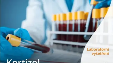 Laboratorní test kortizolu pomocí odběru krve do zkumavek.