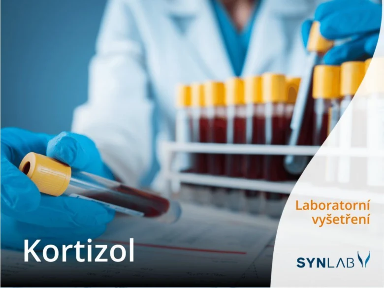 Laboratorní test kortizolu pomocí odběru krve do zkumavek.