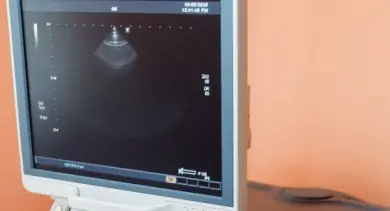 Ultrazvukový monitor zobrazující obraz v lékařském prostředí.