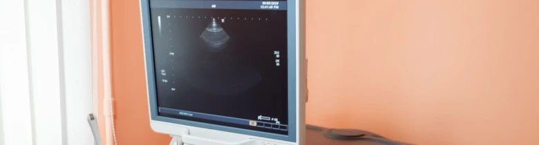 Ultrazvukový monitor zobrazující obraz v lékařském prostředí.
