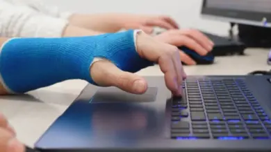 Osoba s natrhanou rukou pracuje na notebooku v kanceláři.