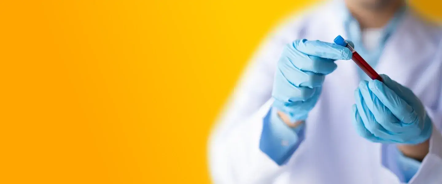 Lékař drží krevní vzorek pro laboratorní vyšetření ALT.