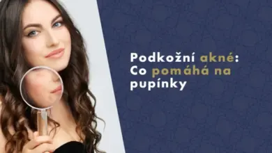 Žena s pupínky pod lupou ukazuje na podkožní akné.