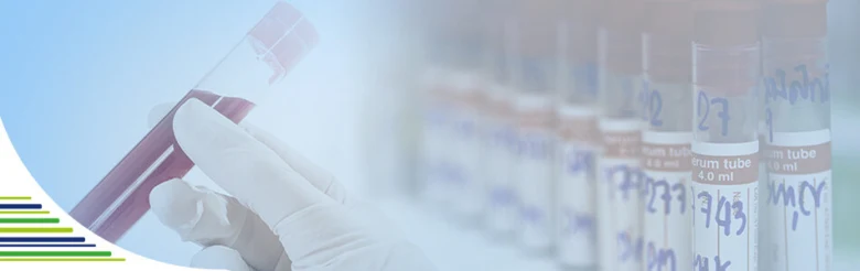 Ruka v rukavici drží zkumavku s krví pro laboratorní vyšetření.