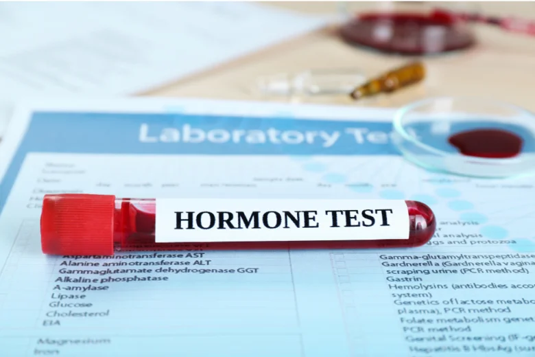 Krevní vzorek pro hormonální test na papíru s výsledky.