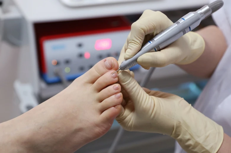 Pedicurista upravuje nehty na noze pomocí elektrického vrtáku.