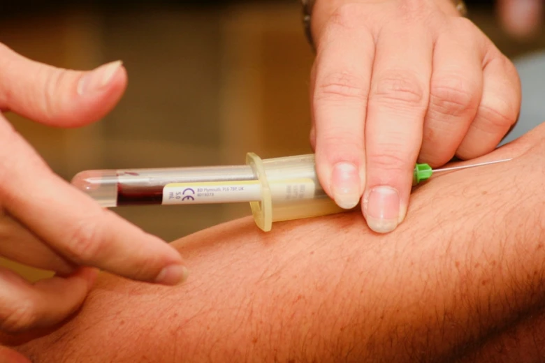 Krevní odběr z paže pomocí špičky pro diagnostiku.