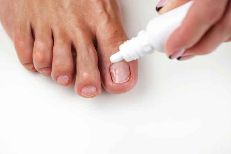 Applying nail treatment drop
