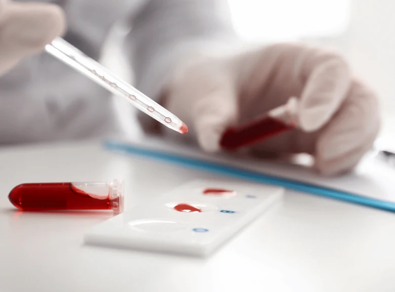 Laborant přenáší krev do testovacího proužku pomocí kapátkové stříkačky.